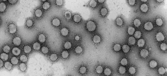 Irus de la familia Coronaviridae. / Luis Enjuanes-CNB-CSIC