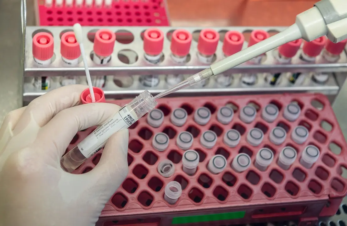 A medical technical assistant prepares samples from patients for virus diagnostics (PCR, polymerase chain reaction) on a microbiological safety workbench in the safety laboratory. Photo: Robert Michael/dpa-Zentralbild/dpa