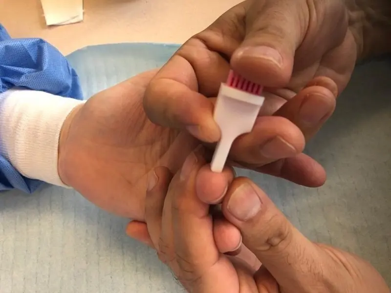 Los miembros de todos los hogares seleccionados para el estudio de prevelancia del Covid-19 se someter&aacute;n a dos tipos de test serol&oacute;gicos