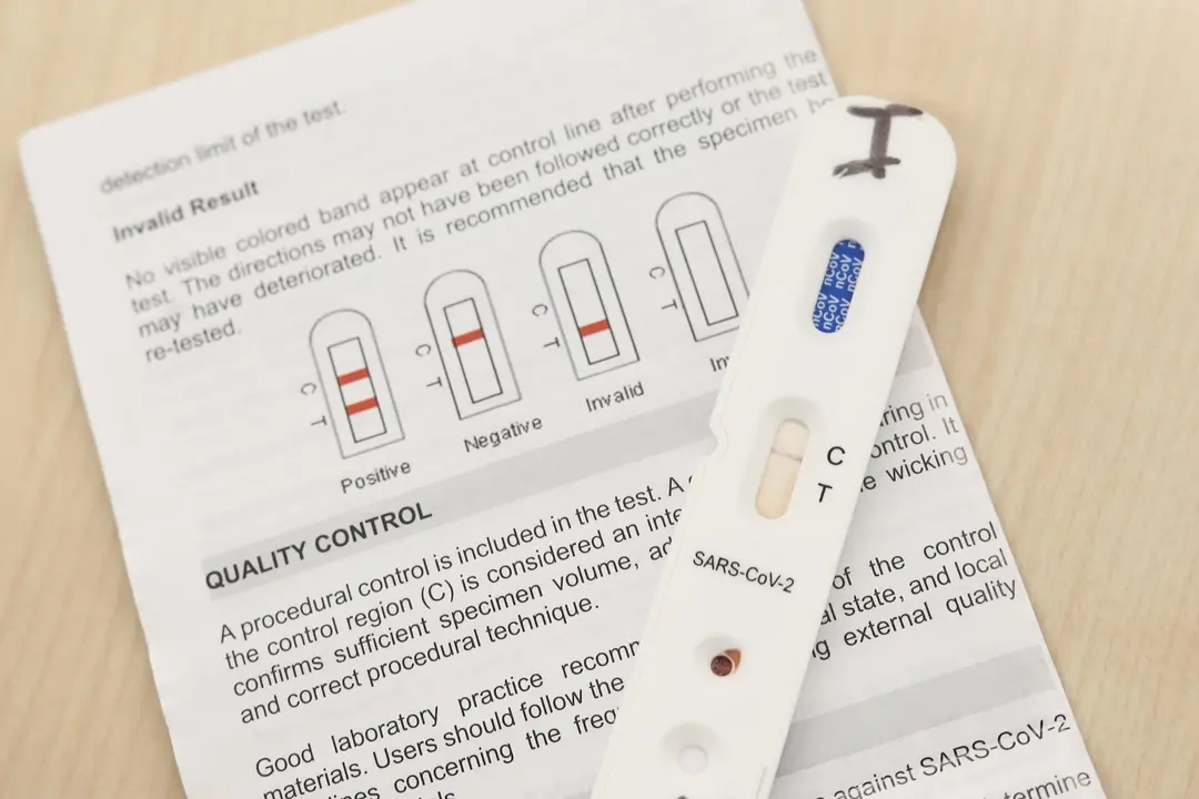 Kits utilizados para la realizaci&oacute;n de los test r&aacute;pidos