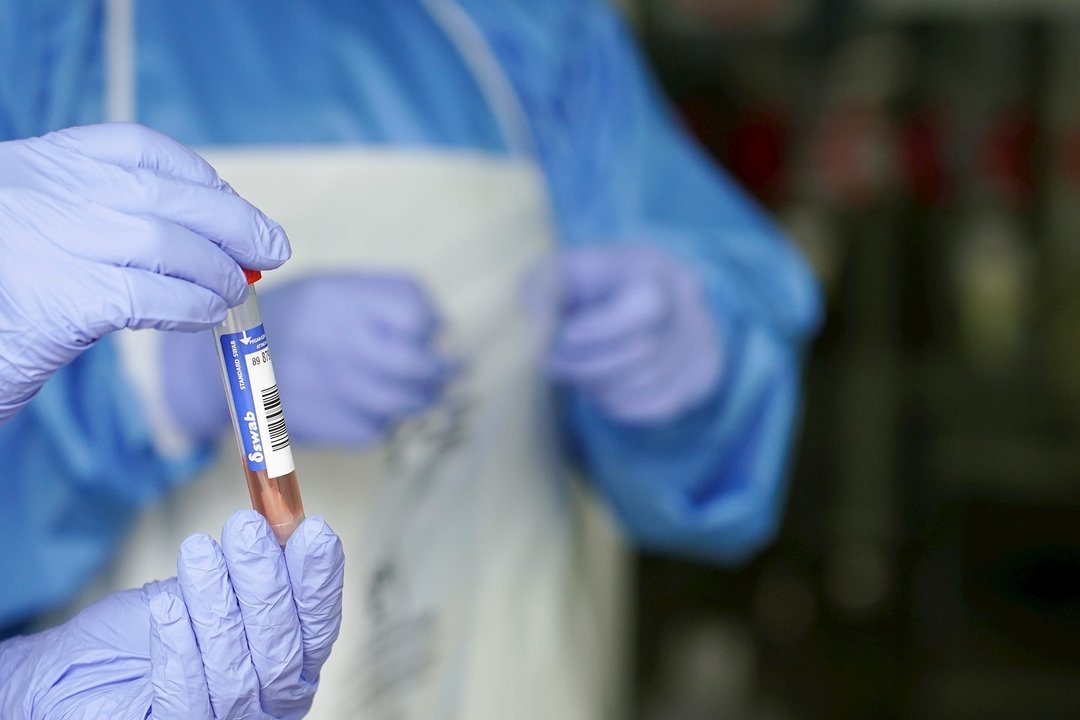 Un sanitario protegido con guantes sostiene un muestra para realizar una prueba PCR  