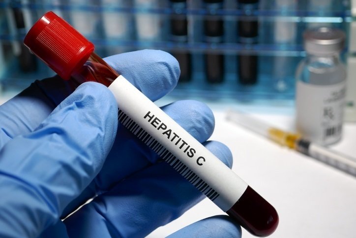 Hepatitis C treatment  Hepatitis C - sexually transmitted disease blood test and treatment