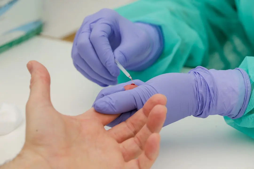 Prueba diagn&oacute;stica del COVID-19