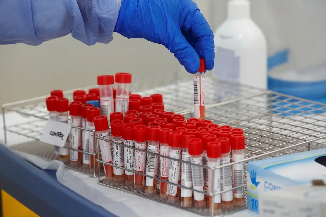 Tubos de pruebas PCR para la detecci&oacute;n del COVID-19.