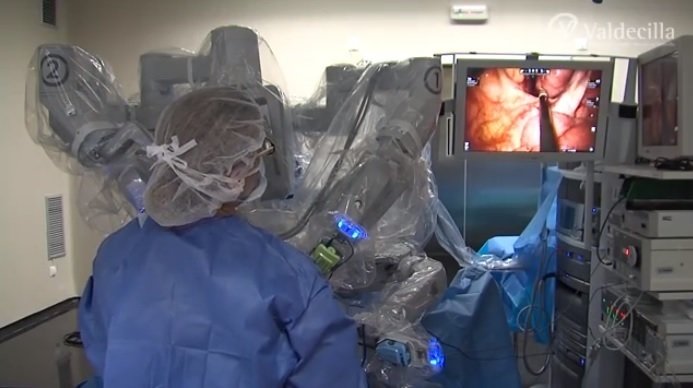 robot quirúrgico 'DaVinci'