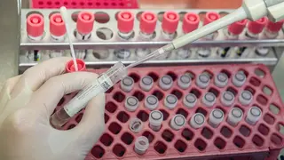 A medical technical assistant prepares samples from patients for virus diagnostics (PCR, polymerase chain reaction) on a microbiological safety workbench in the safety laboratory. Photo: Robert Michael/dpa-Zentralbild/dpa