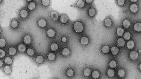 Irus de la familia Coronaviridae. / Luis Enjuanes-CNB-CSIC