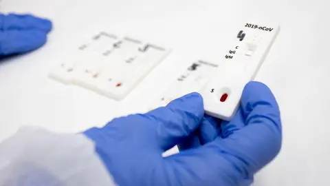 Unas manos con guantes azules sujetan un test