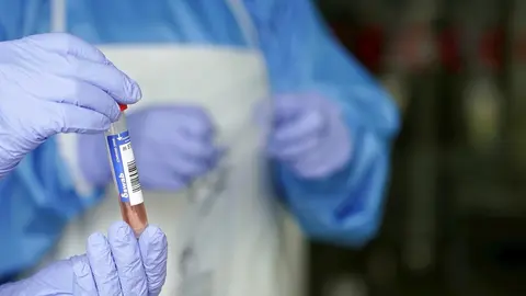 Un sanitario protegido con guantes sostiene un muestra para realizar una prueba PCR  
