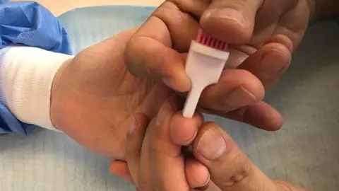 Los miembros de todos los hogares seleccionados para el estudio de prevelancia del Covid-19 se someter&aacute;n a dos tipos de test serol&oacute;gicos