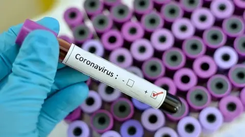 Coronavirus positive  Blood sample with respiratory coronavirus positive