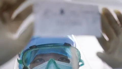 Una enfermera revisa la lista de tratamiento de un paciente pegada en la ventana del Hospital Municipal de Zhangzhou, provincia de Fujian, en el sudeste de China. 2 de febrero de 2020.