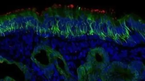 La mancha roja es ACE2. La sonda verde es la tinci&oacute;n CK18, que se encuentra en las c&eacute;lulas de soporte y en las gl&aacute;ndulas mucosas.