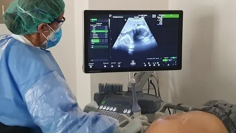 Ecograf&iacute;a a una paciente embarazada