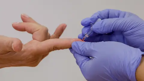 Test de anticuerpos.