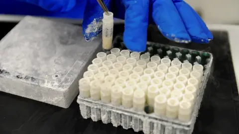 Muestras bio laboratorio Idival