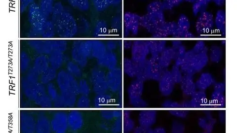 Un equipo del CNIO descubre c&oacute;mo se regula la participaci&oacute;n de los tel&oacute;meros en la generaci&oacute;n de tumores