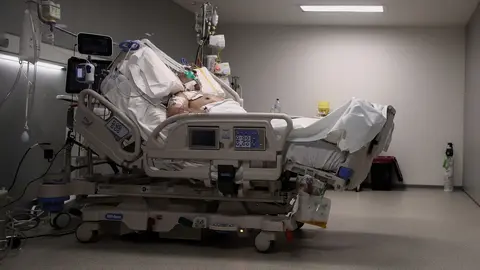 Un enfermo en una cama de la UCI del Hospital de Emergencias Isabel Zendal, Madrid (Espa&ntilde;a), a 20 de enero de 2021. 