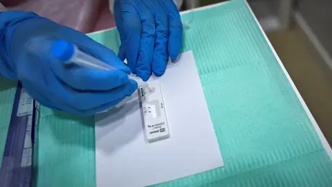 Archivo - Test de ant&iacute;genos