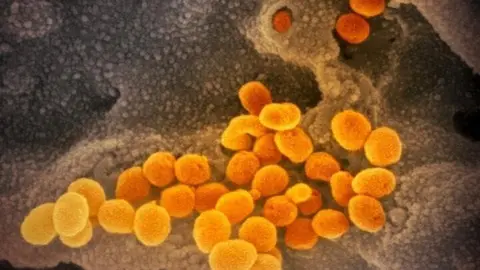Archivo - Esta imagen de microscopio electr&oacute;nico de barrido muestra el SARS-CoV-2 (naranja), el virus que causa la COVID-19, aislado de un paciente en EE.UU. El virus emerge de la superficie de las c&eacute;lulas (gris) cultivadas en el laboratorio.
