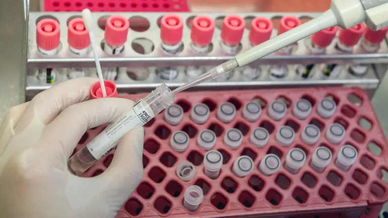 A medical technical assistant prepares samples from patients for virus diagnostics (PCR, polymerase chain reaction) on a microbiological safety workbench in the safety laboratory. Photo: Robert Michael/dpa-Zentralbild/dpa